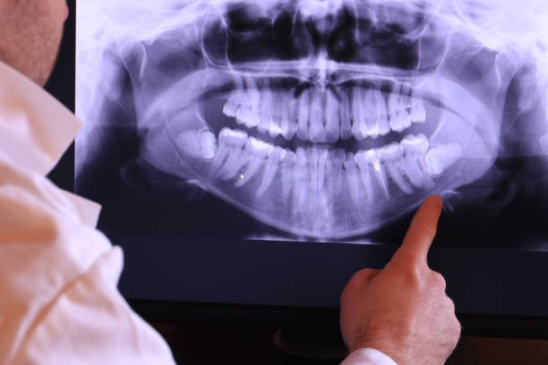 Best Broken or Cracked Tooth Emergency Dentist in Valmeyer, IL