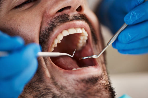 Best Weekend Emergency Dentist in Valmeyer, IL