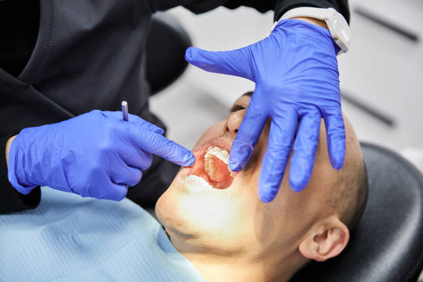 Best Emergency Dentist for Knocked-Out Tooth in Valmeyer, IL